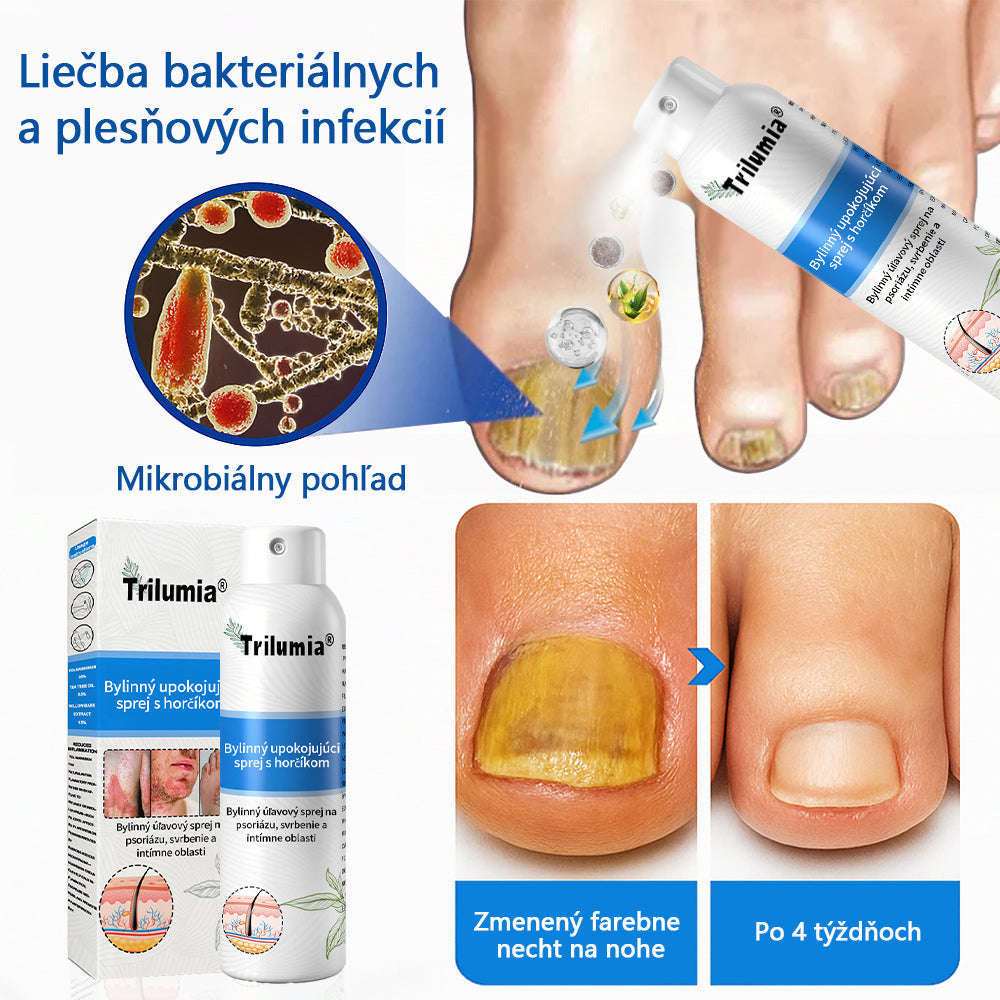Oficiálny obchod✨: Trilumia®Horčíkový bylinný sprej na psoriázu⚕️certifikované FDA (úľava od psoriázy a ekzému, zlepšenie bakteriálnych infekcií v oblasti genitálií a liečba akné a tmavých škvŕn)