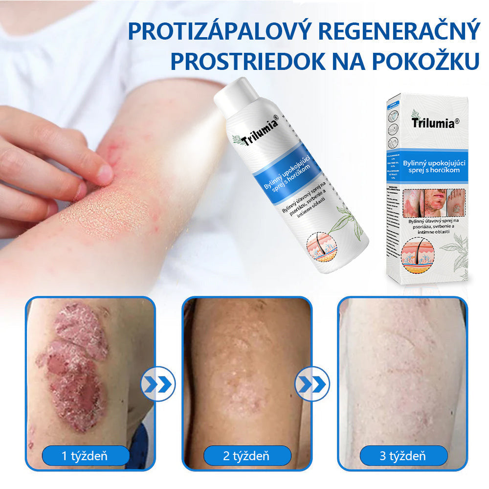 Oficiálny obchod✨: Trilumia®Horčíkový bylinný sprej na psoriázu⚕️certifikované FDA (úľava od psoriázy a ekzému, zlepšenie bakteriálnych infekcií v oblasti genitálií a liečba akné a tmavých škvŕn)
