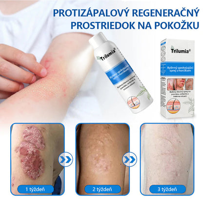 Oficiálny obchod✨: Trilumia®Horčíkový bylinný sprej na psoriázu⚕️certifikované FDA (úľava od psoriázy a ekzému, zlepšenie bakteriálnych infekcií v oblasti genitálií a liečba akné a tmavých škvŕn)