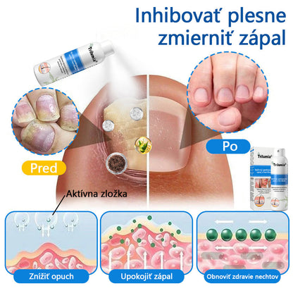 Oficiálny obchod✨: Trilumia®Horčíkový bylinný sprej na psoriázu⚕️certifikované FDA (úľava od psoriázy a ekzému, zlepšenie bakteriálnych infekcií v oblasti genitálií a liečba akné a tmavých škvŕn)