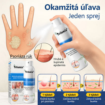 Oficiálny obchod✨: Trilumia®Horčíkový bylinný sprej na psoriázu⚕️certifikované FDA (úľava od psoriázy a ekzému, zlepšenie bakteriálnych infekcií v oblasti genitálií a liečba akné a tmavých škvŕn)