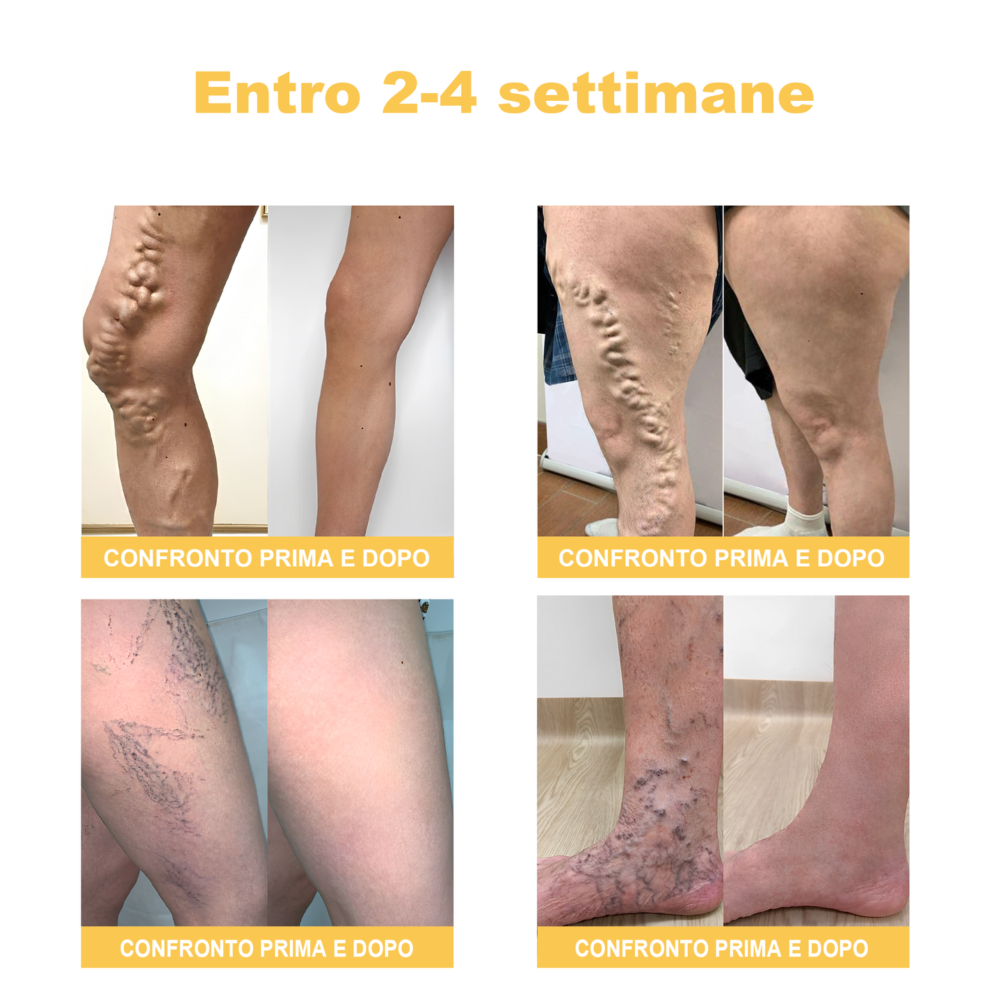 🏆[✨Negozio ufficiale del marchio✨]Zoencgz™ Crema al veleno d'api  per artrite e vene varicose