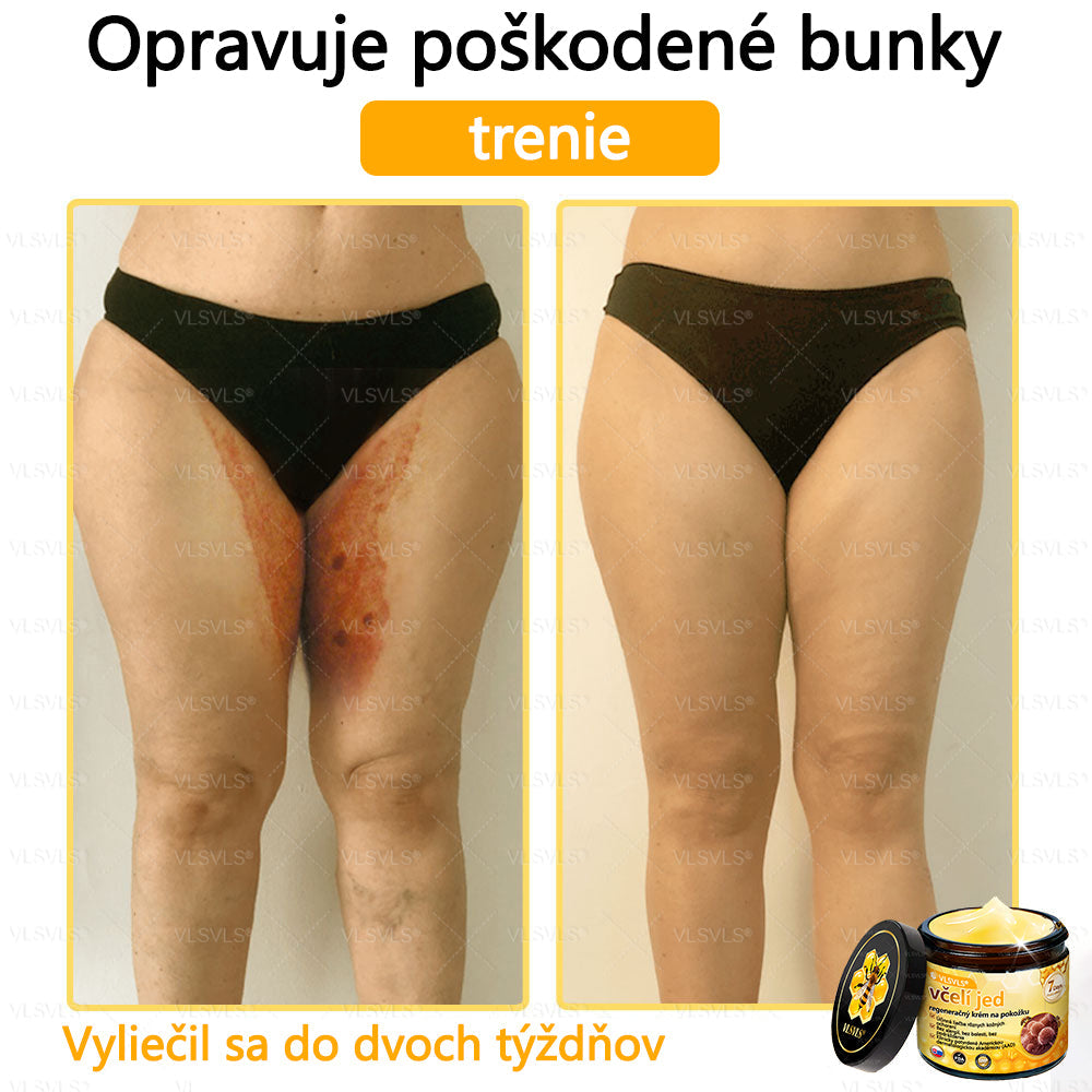 🌿 VLSVLS™ Regeneračný pleťový krém s včelím jedom 🐝 – Obnova ✨ Hydratácia 💧 Omladenie 💫