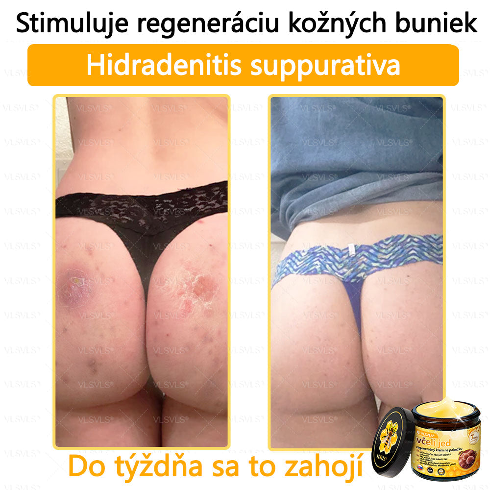 🌿 VLSVLS™ Regeneračný pleťový krém s včelím jedom 🐝 – Obnova ✨ Hydratácia 💧 Omladenie 💫