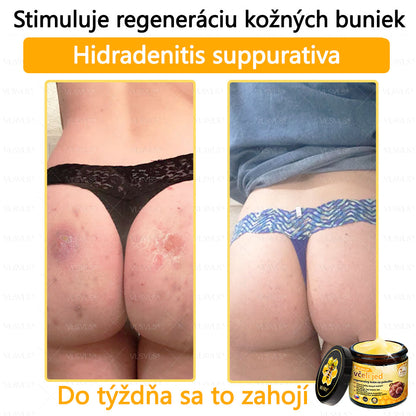 🌿 VLSVLS™ Regeneračný pleťový krém s včelím jedom 🐝 – Obnova ✨ Hydratácia 💧 Omladenie 💫