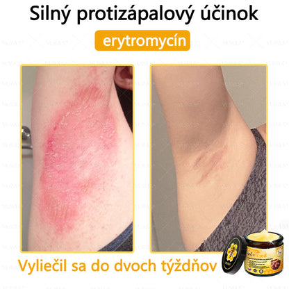 🌿 VLSVLS™ Regeneračný pleťový krém s včelím jedom 🐝 – Obnova ✨ Hydratácia 💧 Omladenie 💫