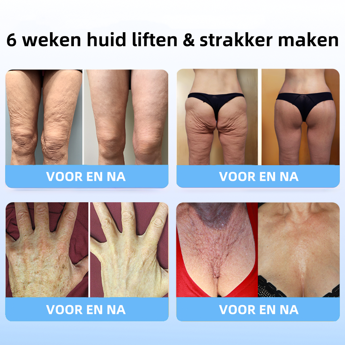 🎉🎉Vyhľadávané produkty! POSLEDNÝ DEŇ VÝPREDAJA: 𝟕5% zľava 🎉Fubsta® Advanced Firming & Wrinkle Reducing Cream: obnovuje pružnosť pokožky - 2024🔥🔥🔥🥰