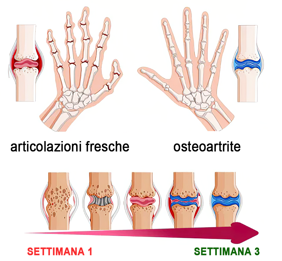 🏆[✨Negozio ufficiale del marchio✨]Zoencgz™ Crema al veleno d'api  per artrite e vene varicose