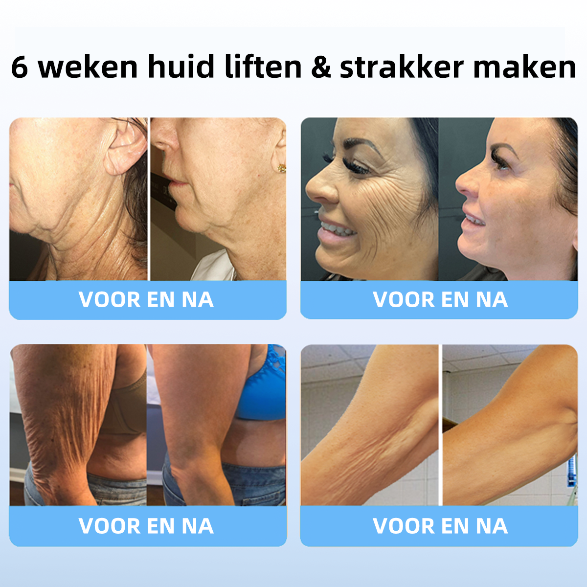 🎉🎉Vyhľadávané produkty! POSLEDNÝ DEŇ VÝPREDAJA: 𝟕5% zľava 🎉Fubsta® Advanced Firming & Wrinkle Reducing Cream: obnovuje pružnosť pokožky - 2024🔥🔥🔥🥰