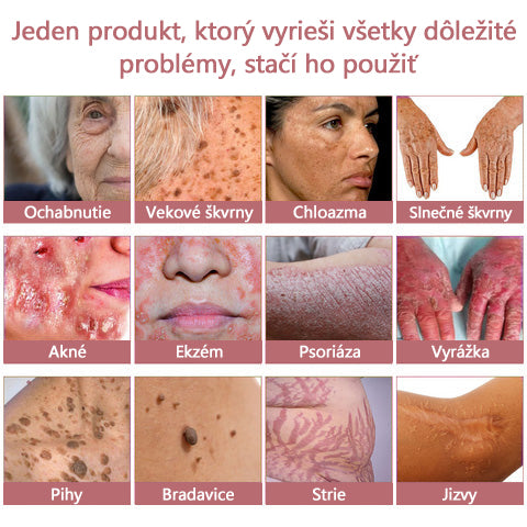 Krém na pleťskolagénom akoenzýmom Q10 v gélovej forme, schválený Slovenskou dermatologickou spoločnosťou (pomáha pri liečbe akné, bradavíc, ružovky, psoriázy, stareckých škvŕn, ekzémov a znižuje výskyt strií).
