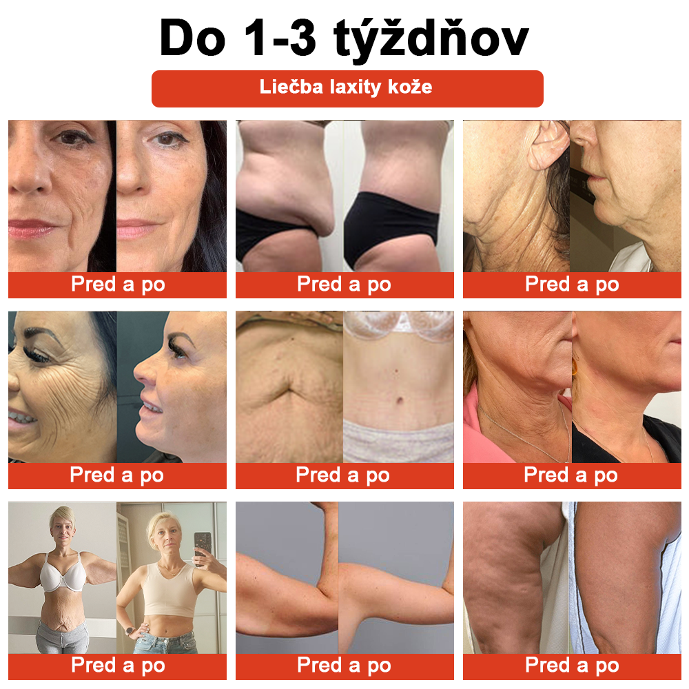 𝗦𝗧𝗗𝗘𝗜™ Magický luxusný telový olej (obmedzená časová zľava 80 % – posledných 30 minút)🌹🔥