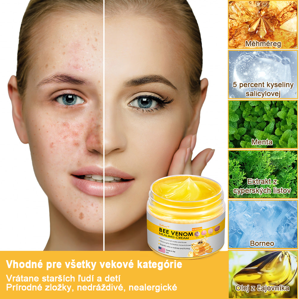 2024 NOVINKA Velisse™ Pleťový krém s včelím jedom(🧑‍⚕️Odporúča sa AAD), na odstránenie bradavíc, akné a jaziev – lieči viaceré kožné stavy
