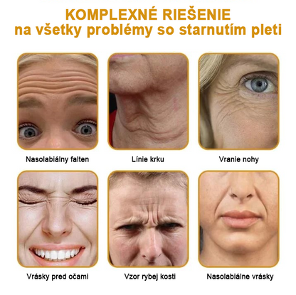 🍀👩‍⚕️Získajte mladistvú pleť hneď teraz! - 👩‍⚕️Furzero™ Botoxový krém na odstraňovanie vrások s obsahom včelieho jedu - (posledný deň 70% zľava)