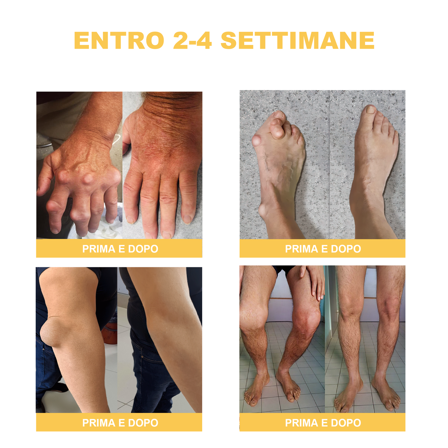 🏆[✨Negozio ufficiale del marchio✨]Zoencgz™ Crema al veleno d'api  per artrite e vene varicose