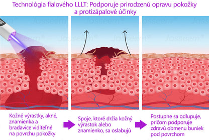 𝐉𝐚𝐬𝐬𝐞𝐞𝐦® Pokročilé neinvazívne CO₂ laserové pero na opravu pokožky 💕 (Jemne odstraňuje bradavice, materské znamienka, starecké škvrny a kožné výrastky – bez bolesti, bez starostí!)