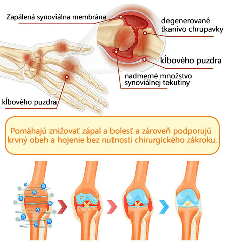 Foulme® Krém na hojenie kostí s botulotoxínom a včelím jedom ⭐👨‍⚕️