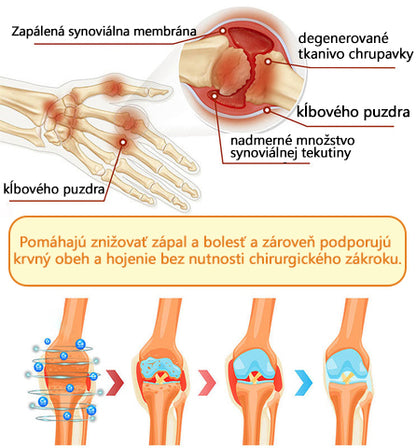 Foulme® Krém na hojenie kostí s botulotoxínom a včelím jedom ⭐👨‍⚕️