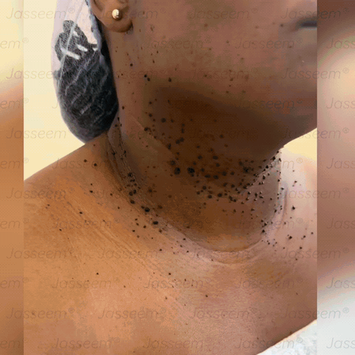 𝐉𝐚𝐬𝐬𝐞𝐞𝐦® Pokročilé neinvazívne CO₂ laserové pero na opravu pokožky 💕 (Jemne odstraňuje bradavice, materské znamienka, starecké škvrny a kožné výrastky – bez bolesti, bez starostí!)