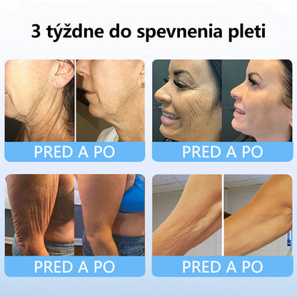 Flysmus™ Kolagénové peptidy SPEVŇUJÚCE SÉRUM v tyčinke 🎉 Certifikované Slovenským ústavom hygieny (SÚH) a Slovenskou dermatologickou spoločnosťou (SDS), zaručujúce najvyššiu kvalitu a bezpečnosť pre vašu pleť.