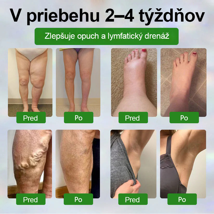 🌿🌿🌿Dorina® Bylinný krém na zmiernenie opuchov s čiernou rascou.