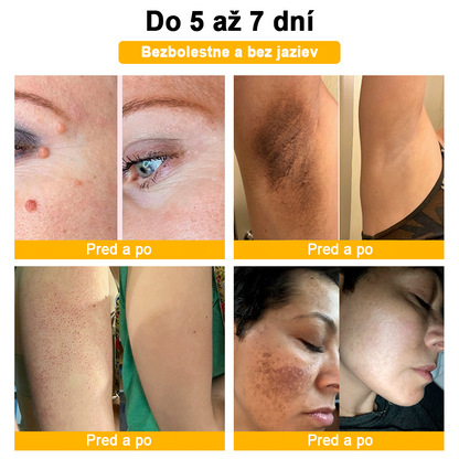 🏵️[Oficiálny vlajkový obchod] 𝑻𝒖𝒓𝒐𝒏𝒖™ Krém na ošetrenie pleti s včelím jedom (👨‍⚕𝐀𝐀𝐃 ODPORÚČANIA)