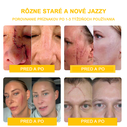 2024 NOVINKA Velisse™ Pleťový krém s včelím jedom(🧑‍⚕️Odporúča sa AAD), na odstránenie bradavíc, akné a jaziev – lieči viaceré kožné stavy