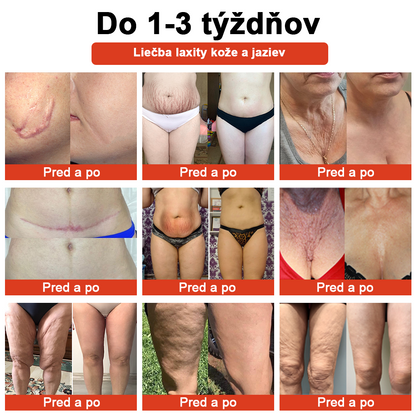 𝗦𝗧𝗗𝗘𝗜™ Magický luxusný telový olej (obmedzená časová zľava 80 % – posledných 30 minút)🌹🔥