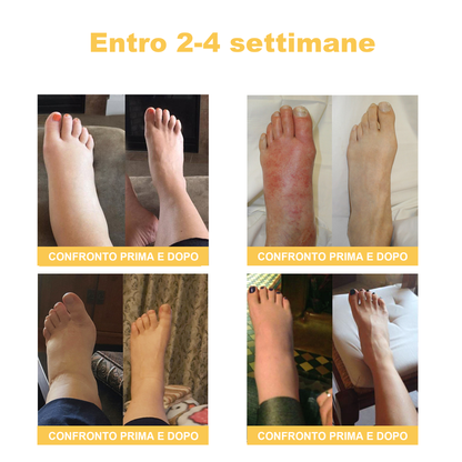 🏆[✨Negozio ufficiale del marchio✨]Zoencgz™ Crema al veleno d'api  per artrite e vene varicose
