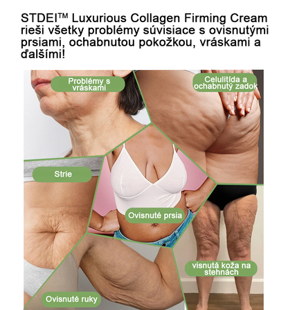 𝐒𝐓𝐃𝐄𝐈™ Kolagénový spevňujúci krém (🔥Časovo obmedzená zľava 74%!) 🏆