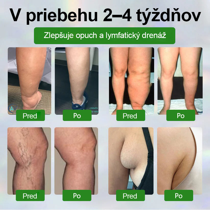 🌿🌿🌿Dorina® Bylinný krém na zmiernenie opuchov s čiernou rascou.