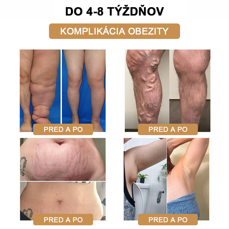 ✨🐳Najnovšie ultrazvukové detoxikačné hodinky SlimPulse™ 2024 – energetická bilancia🎁 (obmedzená časová zľava + odporúčané lekárom)