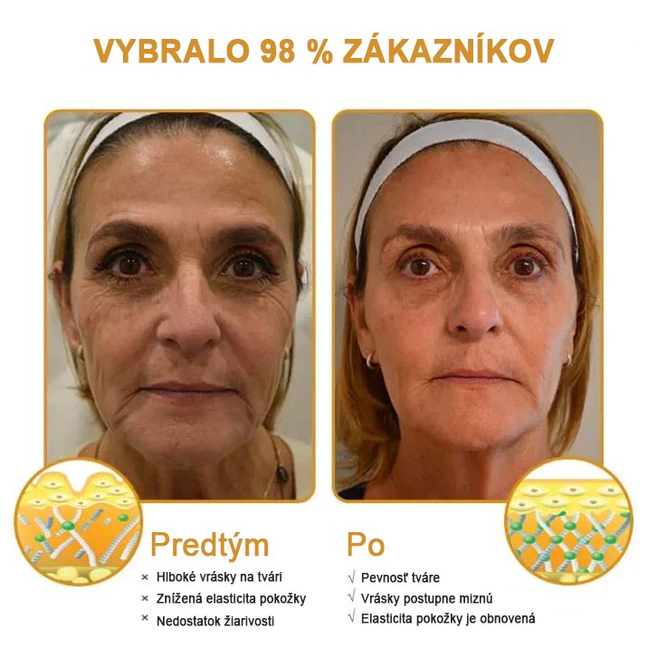 🍀👩‍⚕️Získajte mladistvú pleť hneď teraz! - 👩‍⚕️Furzero™ Botoxový krém na odstraňovanie vrások s obsahom včelieho jedu - (posledný deň 70% zľava)