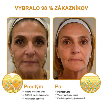 🍀👩‍⚕️Získajte mladistvú pleť hneď teraz! - 👩‍⚕️Furzero™ Botoxový krém na odstraňovanie vrások s obsahom včelieho jedu - (posledný deň 70% zľava)
