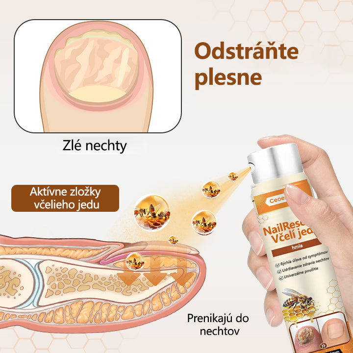 2025🎁 Limitovaná akcia 70% ZĽAVA ️ ️⏳ Ceoerty® Sprej na nechtovú hubu s včelím jedom 💥 Oprava všetkých problémov s nechtami do 2 týždňov