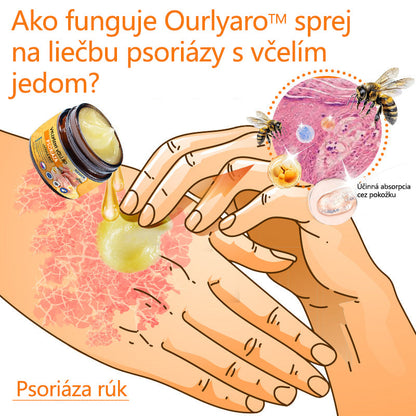 🌿Pokročilá masť na liečbu psoriázy Ourlyard™ (👨‍⚕Odporúčané lekárom) je certifikovaná Slovenským ústavom liečiv a zdravotníckych pomôcok (BFARM) a získala certifikáciu CE.