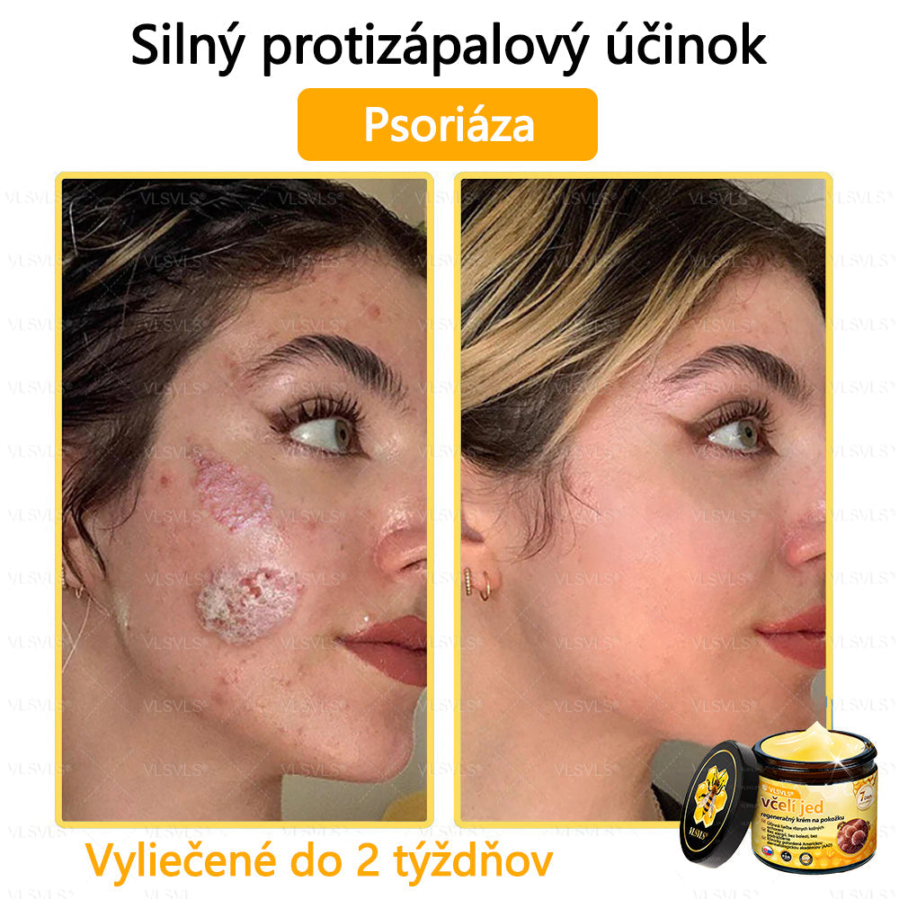 🌿 VLSVLS™ Regeneračný pleťový krém s včelím jedom 🐝 – Obnova ✨ Hydratácia 💧 Omladenie 💫