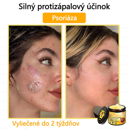 🌿 VLSVLS™ Regeneračný pleťový krém s včelím jedom 🐝 – Obnova ✨ Hydratácia 💧 Omladenie 💫