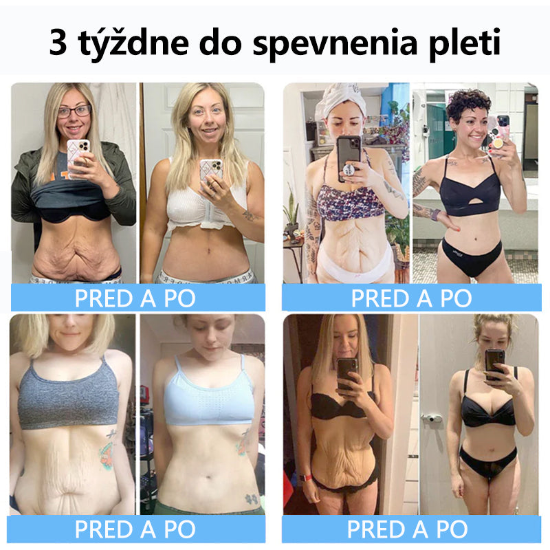 Flysmus™ Kolagénové peptidy SPEVŇUJÚCE SÉRUM v tyčinke 🎉 Certifikované Slovenským ústavom hygieny (SÚH) a Slovenskou dermatologickou spoločnosťou (SDS), zaručujúce najvyššiu kvalitu a bezpečnosť pre vašu pleť.