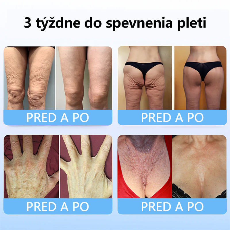 Flysmus™ Kolagénové peptidy SPEVŇUJÚCE SÉRUM v tyčinke 🎉 Certifikované Slovenským ústavom hygieny (SÚH) a Slovenskou dermatologickou spoločnosťou (SDS), zaručujúce najvyššiu kvalitu a bezpečnosť pre vašu pleť.