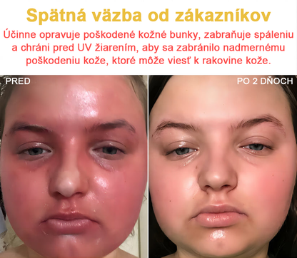 2024 NOVINKA Velisse™ Pleťový krém s včelím jedom(🧑‍⚕️Odporúča sa AAD), na odstránenie bradavíc, akné a jaziev – lieči viaceré kožné stavy