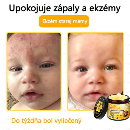 🌿 VLSVLS™ Regeneračný pleťový krém s včelím jedom 🐝 – Obnova ✨ Hydratácia 💧 Omladenie 💫
