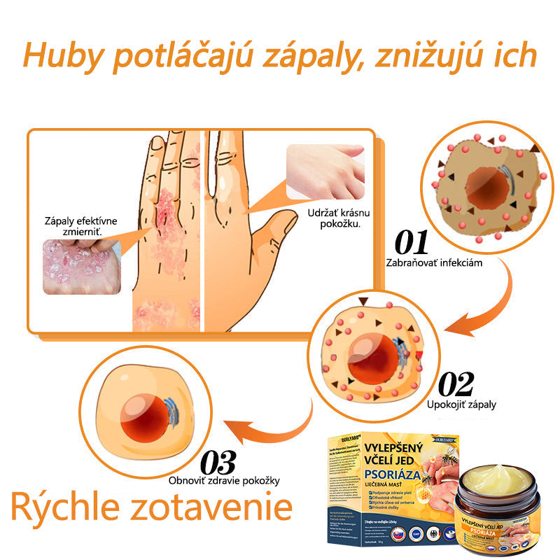 🌿Pokročilá masť na liečbu psoriázy Ourlyard™ (👨‍⚕Odporúčané lekárom) je certifikovaná Slovenským ústavom liečiv a zdravotníckych pomôcok (BFARM) a získala certifikáciu CE.