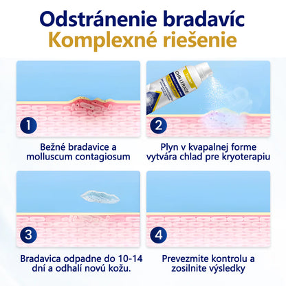 ❄️Timilk® ChillErase obnovujúci sprej proti kožným výrastkom