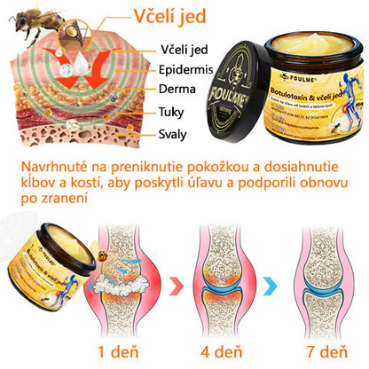 Foulme® Krém na hojenie kostí s botulotoxínom a včelím jedom ⭐👨‍⚕️