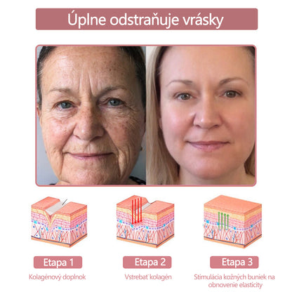 Krém na pleťskolagénom akoenzýmom Q10 v gélovej forme, schválený Slovenskou dermatologickou spoločnosťou (pomáha pri liečbe akné, bradavíc, ružovky, psoriázy, stareckých škvŕn, ekzémov a znižuje výskyt strií).