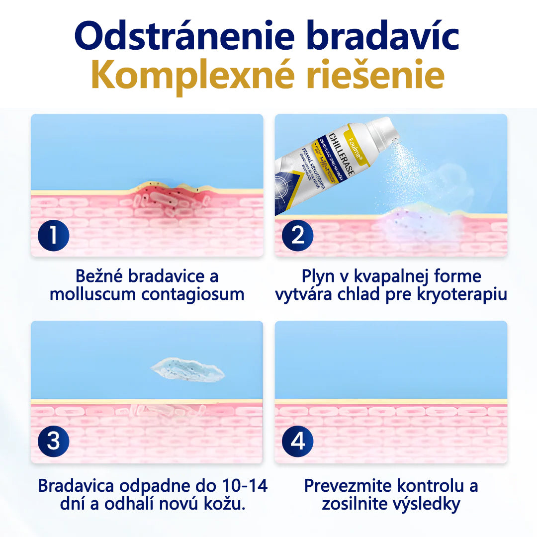 ❄️Foulme® ChillErase obnovujúci sprej proti kožným výrastkom