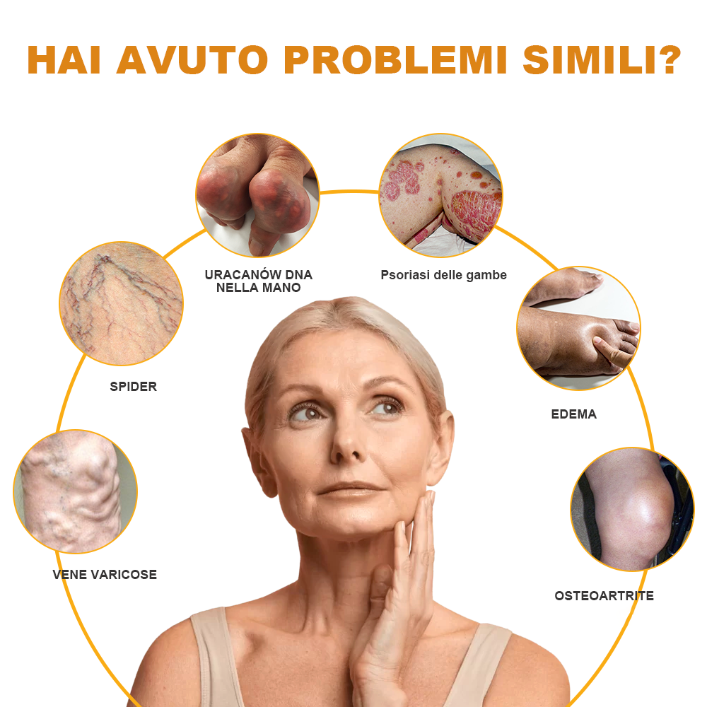 🏆[✨Negozio ufficiale del marchio✨]Zoencgz™ Crema al veleno d'api  per artrite e vene varicose