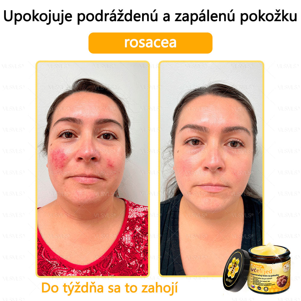 🌿 VLSVLS™ Regeneračný pleťový krém s včelím jedom 🐝 – Obnova ✨ Hydratácia 💧 Omladenie 💫
