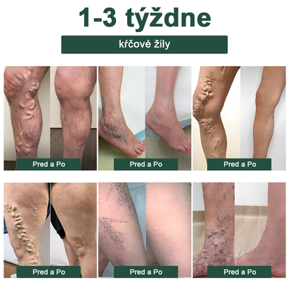 Zostáva iba 5 pohárov! Ponúkame Vám dodatočnú zľavu 50%! Získajte zdravé telo. Ak vám chýba teraz, dostanete ho až budúci rok.