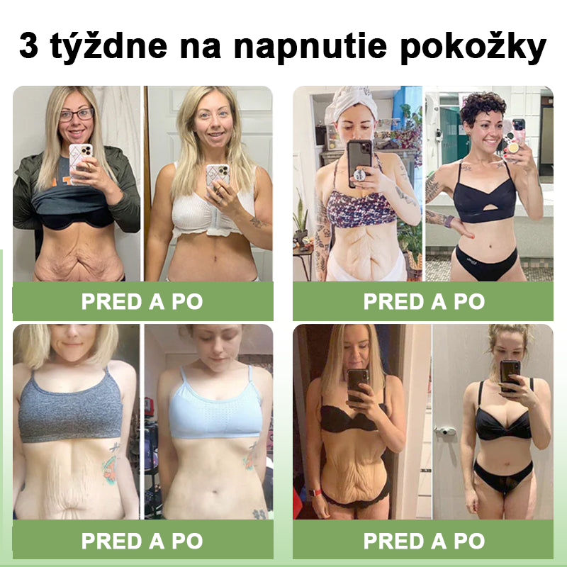 𝐒𝐓𝐃𝐄𝐈™ Kolagénový spevňujúci krém (🔥Časovo obmedzená zľava 74%!) 🏆